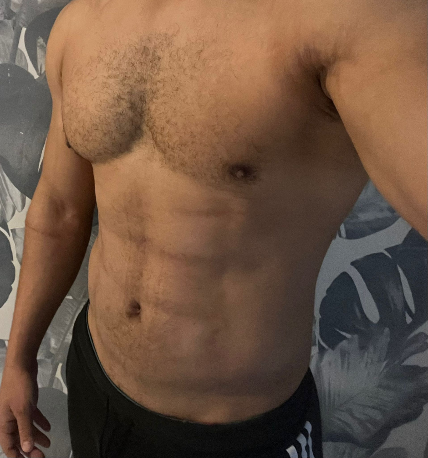 نحت دهون البطن وإظهار الـ Six Packs - بعد